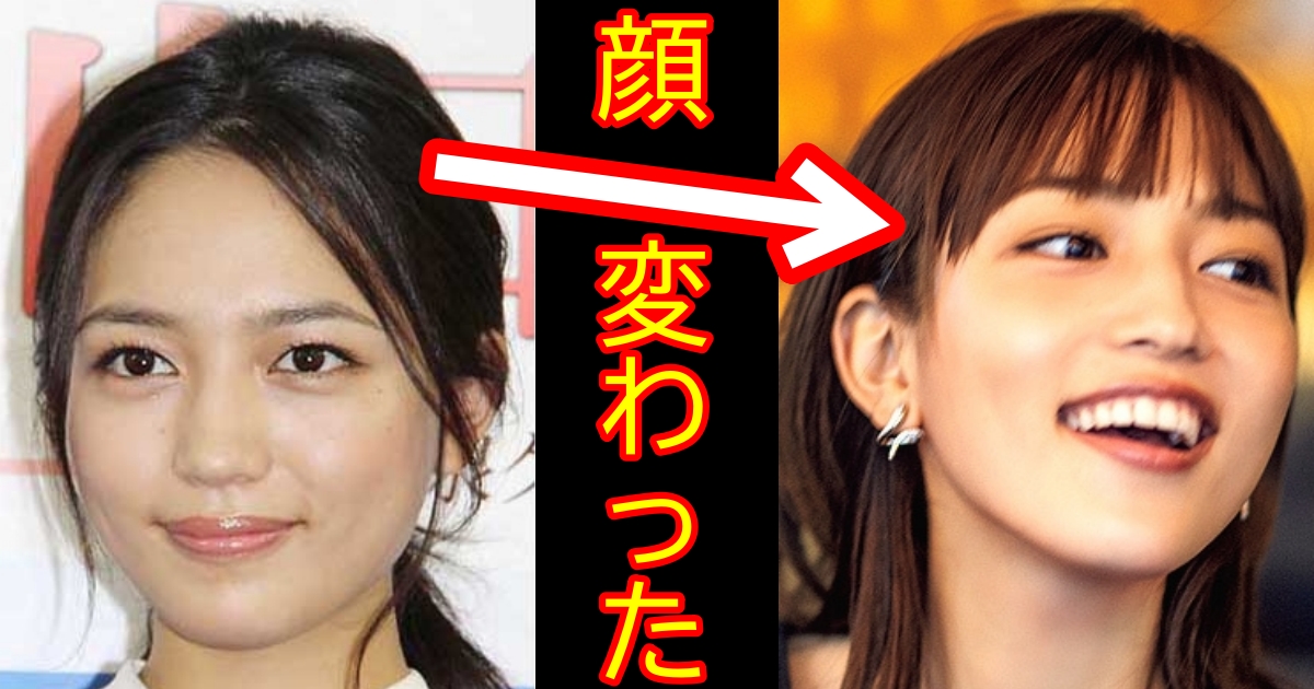 出っ歯疑惑 川口春奈の口元を徹底検証してみた 芸能デラックス